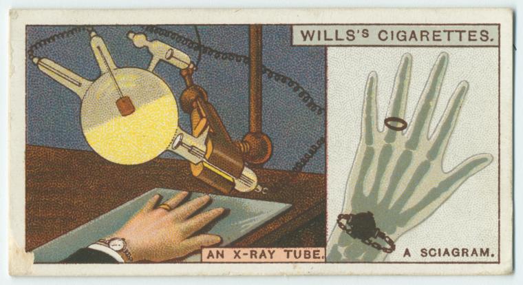 Do you know what the x-rays are?, Digital ID 1519277, New York Public Library