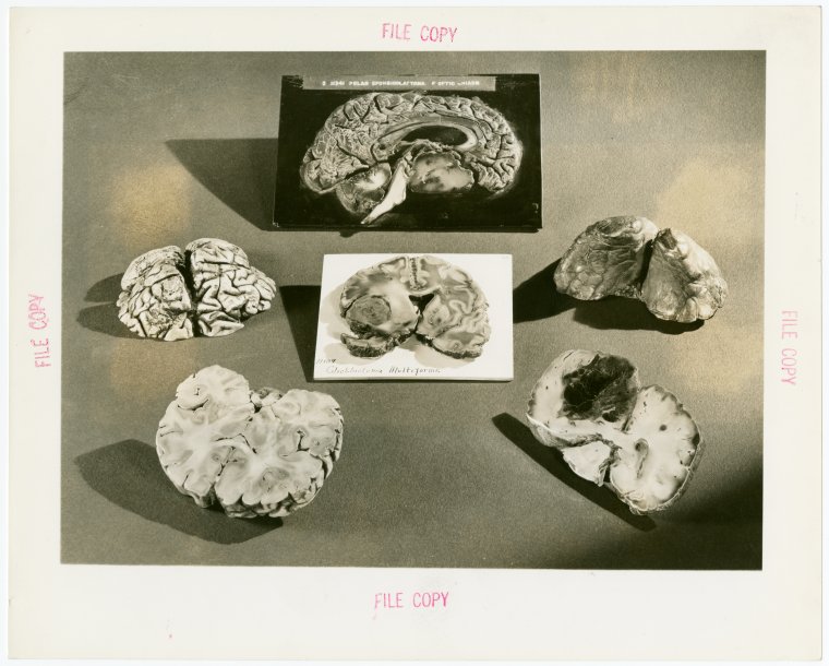 Bakelite Plastics Exhibit - Brains coated in plastic, Digital ID 1664965, New York Public Library