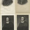 Cardinal Beaton [four portraits].