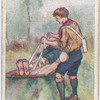 Fracture of the Leg.
