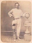 Clothed man stands facing camera, shortened right leg encased in brace, with his right foot resting on an artificial foot. His left arm rests on a decorative column