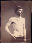 James Brownlee : Wounds in chest & abdomen [Three-quarter view, shirtless man standing, clothing adjusted to show gunshot wounds to chest and lower abdomen]