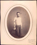 Shirtless man, standing, with right arm in brace and harness, right hand resting on chair