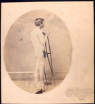 [Side view of naked man standing with crutches to display shortened right leg with foot resting on a wooden object] / Johnson  D’Utassy