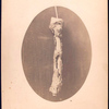 Humerus removed from right arm of John F. Claghorn, 214 Gold St. Brooklyn, L.I. Operation performed by Dr. James B. [Cutter or Cutler], 384 Broad St. Newark N.J. / Johnson  D’Utassy, Photographers