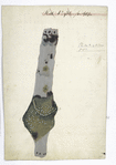 Pl. No. 4 of Dr. Jones’ papers. Alternate title: [Appearance of Femoral Vein in a case of pyaemia.] / [Joseph Jones]