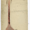 Plate 3. Dr. Gouley’s case of osteo-myelitis after compound fracture of femur from R.R. injury. Upper moiety. Case 11. Michael Stack. / from nature by R. Köhler