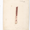 Plate 8. Case of osteo-myelitis following a fracture of the humerus. The fragments did not unite,  amputation was made. Longitudinal section of upper fragment. Case 48. / Drawn from nature by Aug. H. Heyer Nov. 21st 1865