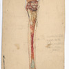 Plate 10. Dr. Van [Buren’s] case of acute osteomyelitis in a girl eleven years old. Longitudinal section of [specimen]. Successful amputation at [knee]- joint. Case 49