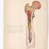 Plate 13. [John Schmidt (…) 28. Amputation at hip joint. Sept. 1866. By Dr. Hamilton. / from nature by R. Köhler.]