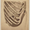[Photograph of illustration of human rib cage] New York : Hamilton, photographer, 1865