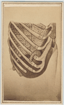 [Photograph of illustration of human rib cage] New York : Hamilton, photographer, 1865