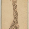 [Humerus bone] Newark, N.J. : Decamp  Crane, photographers
