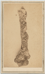 [Humerus bone] Newark, N.J. : Decamp  Crane, photographers
