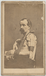 Shirtless seated man displays left arm in splint, resting in sling of striped cloth