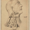 Photograph of illustration showing male head in right profile with exposed muscles and veins of neck, with inserted metal probe