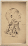 Photograph of illustration showing male head in right profile with exposed muscles and veins of neck, with inserted metal probe