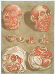 Cette planche représente, en detail & de grandeur naturelle, les muscles de le face....