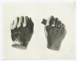 Cast of Abraham Lincoln's hands (reduced in size).