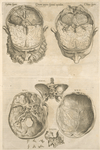 Quarta pagina figurarum capitalium [12 illustrations of the brain]