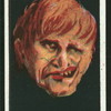 Man with twisted lip.