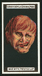 Man with twisted lip.