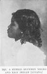 A hybrid between Negro and East Indian [Guiana].