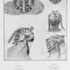 Coiffure type de femme sonraï du pays de Gao (Niger) ; Fig. 6 partie superieure ; Fig. 7 tete vue de trois quarts ; Coiffure type de femme sonraï de la vallee du Niger (Gao) ; Fig. 8 partie superieure ; Fig. 9 dos ; Fig. 10 profil.