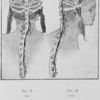 Coiffure type de femme sonraï du pays de Gao (Niger) ; Fig. 11 dos ; Fig. 12 profil.