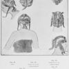 Coiffures de femmes de forgerons sonraï du pays de Gao (Niger).