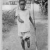 Impongi, a boy of Illnega; Mutilated by State soldiers