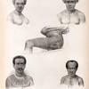 Tonga-Tabou. 1. Naou, jeune  Fille., 2. Natuf de Conga  habitant des îles Viti., 3. Houïtai, chef chrétien à Mafanga., 4. Ata, chef chrétien à hifo., 5. Tatouage de la Cuisse des hommes.