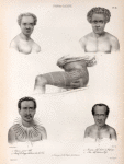 Tonga-Tabou. 1. Naou, jeune  Fille., 2. Natuf de Conga  habitant des îles Viti., 3. Houïtai, chef chrétien à Mafanga., 4. Ata, chef chrétien à hifo., 5. Tatouage de la Cuisse des hommes.