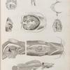 Zoologie. Poissons du Nil. Hétérobranches. Détails anatomiques.
