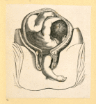 Illustrations of women's anatomy; conjoined twins, and a church.