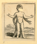 Illustrations of women's anatomy; conjoined twins, and a church.