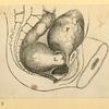 Illustrations of women's anatomy; conjoined twins, and a church.