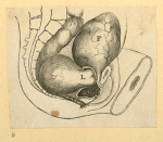 Illustrations of women's anatomy; conjoined twins, and a church.