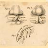 Illustrations of human anatomy and medical procedures.
