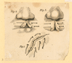 Illustrations of human anatomy and medical procedures.