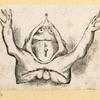 Illustrations of human anatomy and medical procedures.