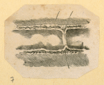 Illustrations of human anatomy and medical procedures.
