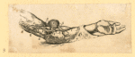 Illustrations of human anatomy and medical procedures.