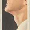 How did the "Adam's apple" get its name?