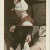 Bandages for scalp and knee.