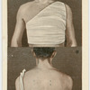 Bandages for chest and back.