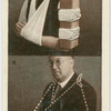 Fractured arm - 2.