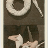 Ring pad and bandaging.