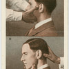 Pressure points on the head.