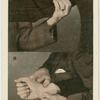 Pressure points on the arm.
